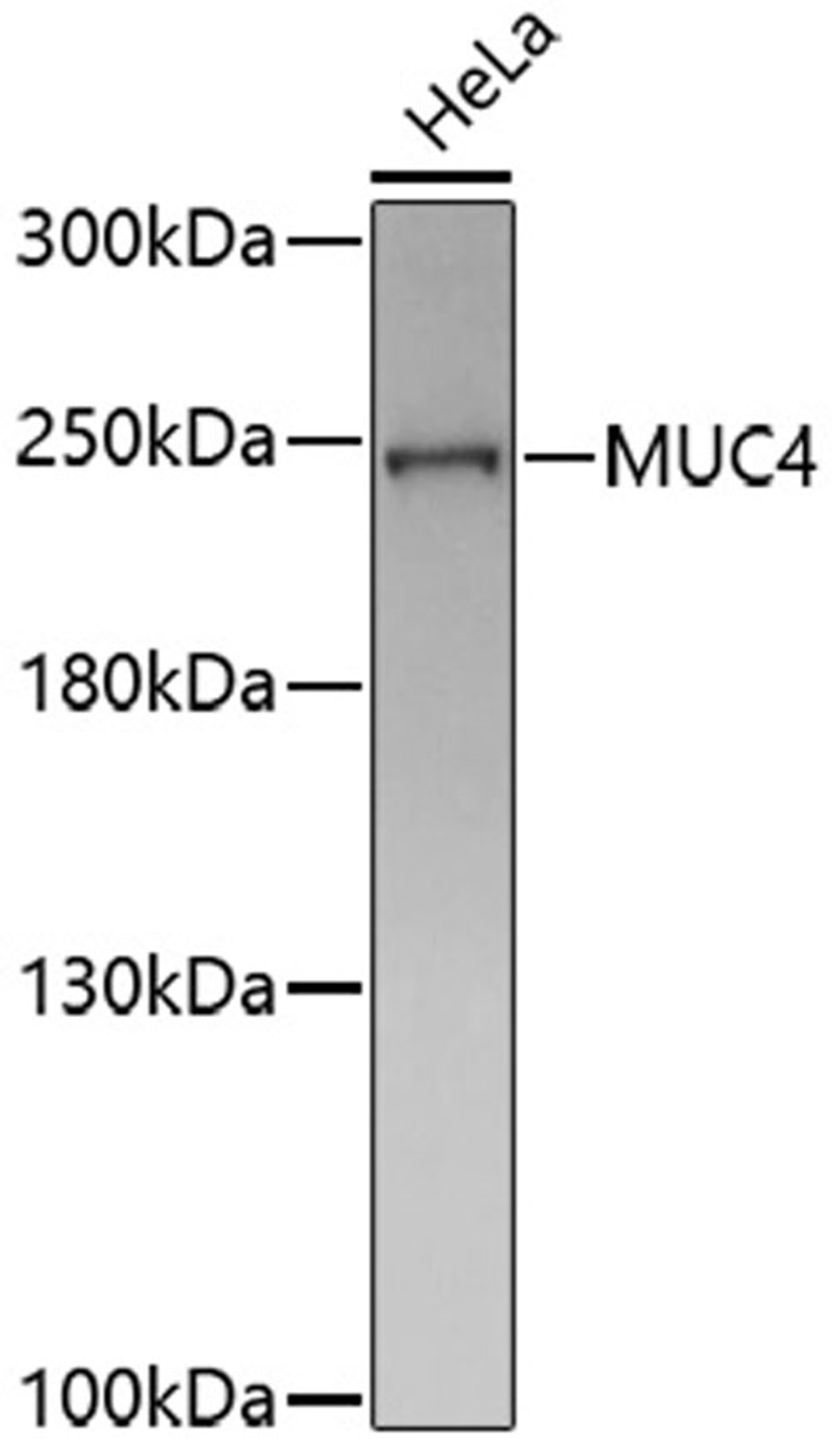 Western blot - MUC4 antibody (A16922)