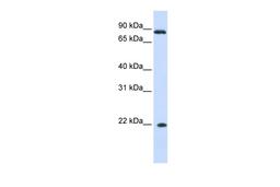 Antibody used in WB on Human Liver at 0.2-1 ug/ml.