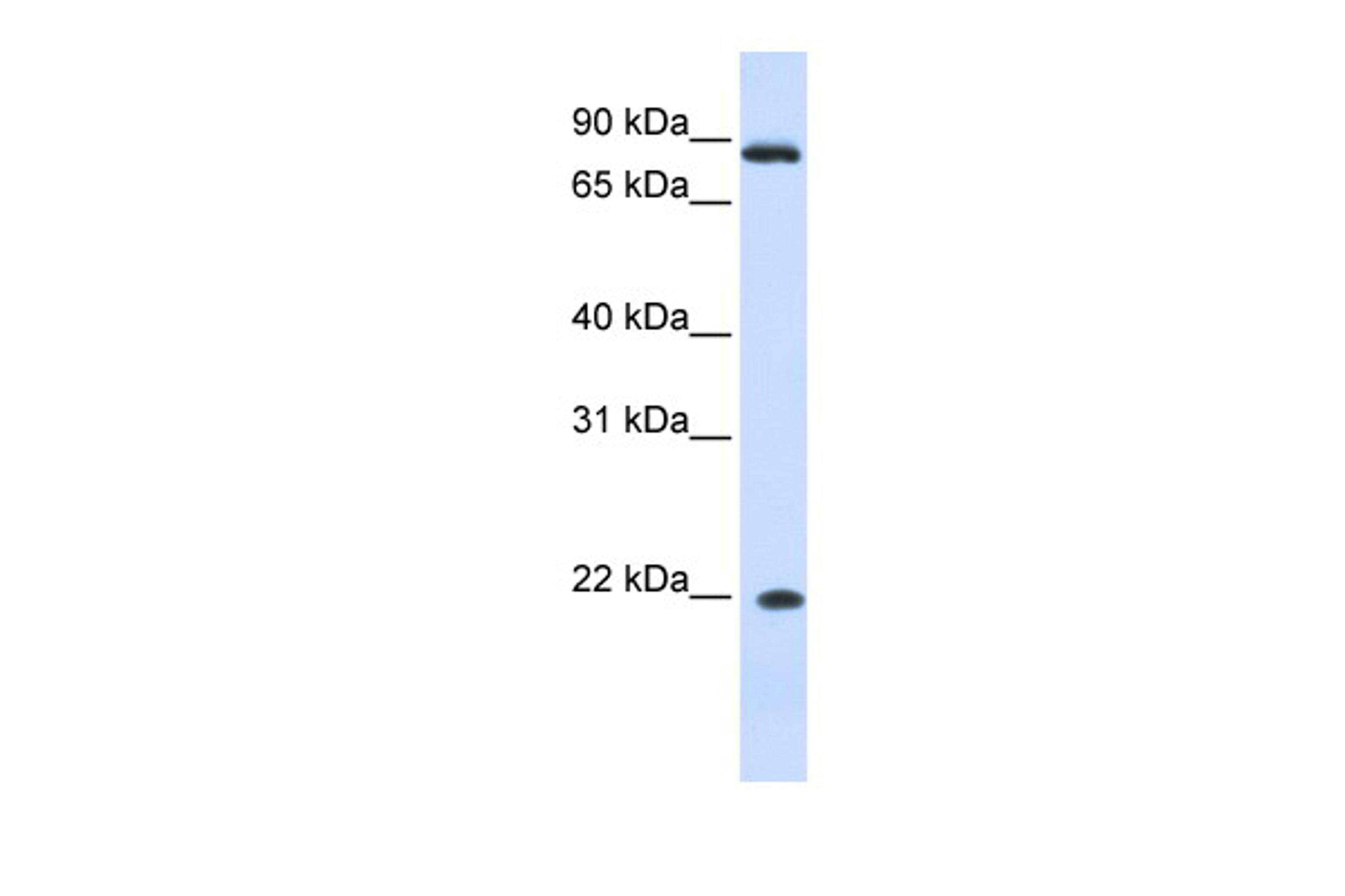 Antibody used in WB on Human Liver at 0.2-1 ug/ml.