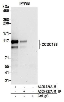 Detection of human CCDC186 by WB of IP.