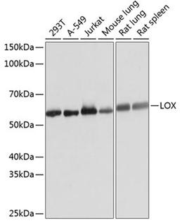 Western blot - LOX Rabbit mAb (A11504)