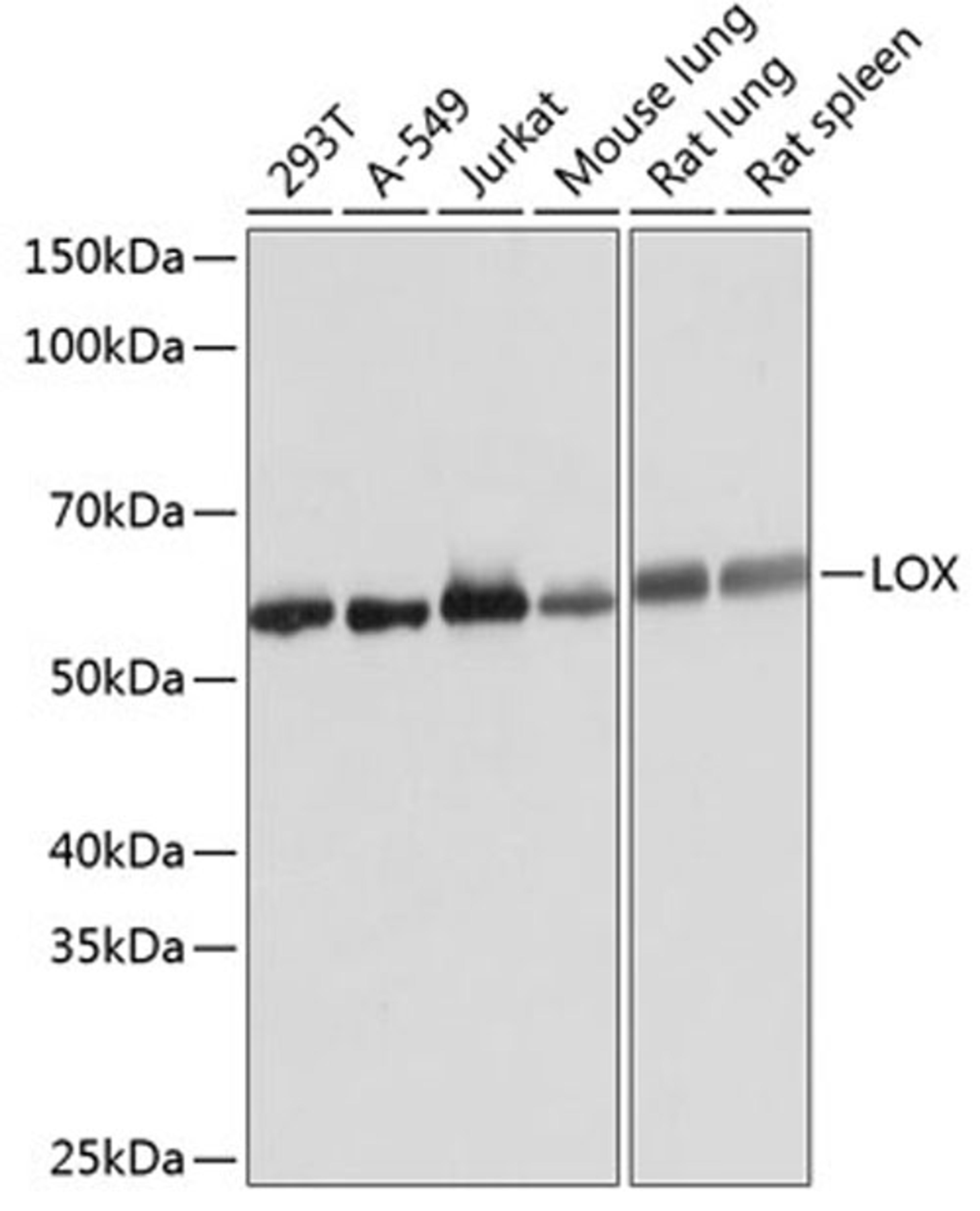 Western blot - LOX Rabbit mAb (A11504)