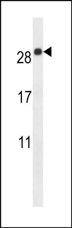 Western blot analysis in mouse lung tissue lysates (35ug/lane).