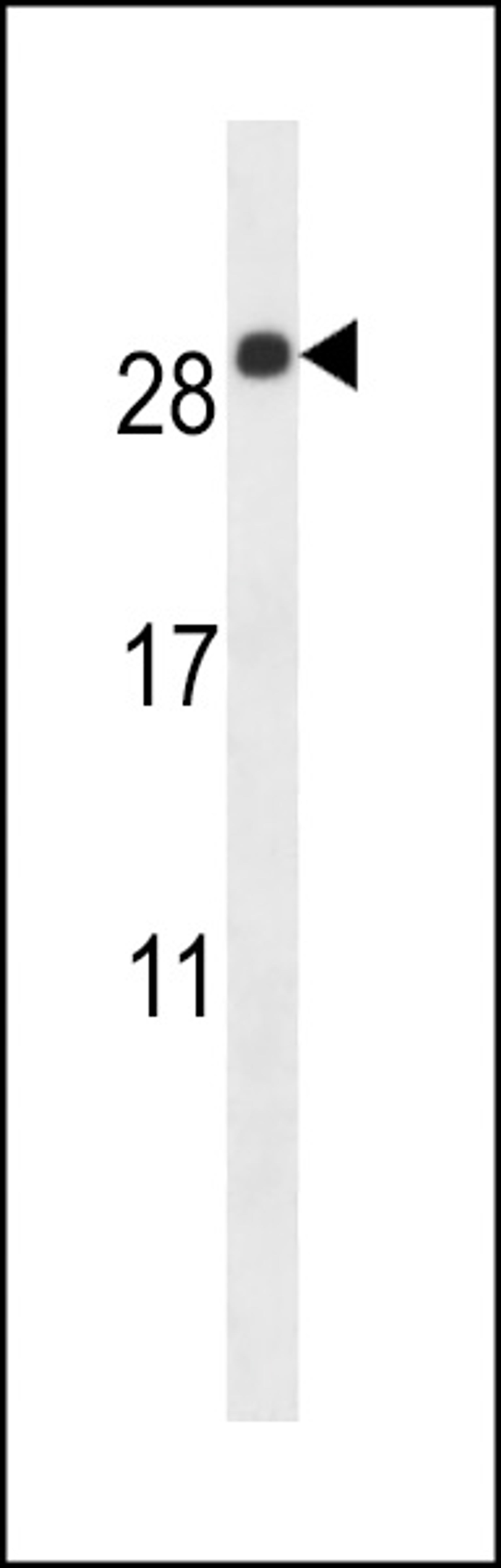 Western blot analysis in mouse lung tissue lysates (35ug/lane).