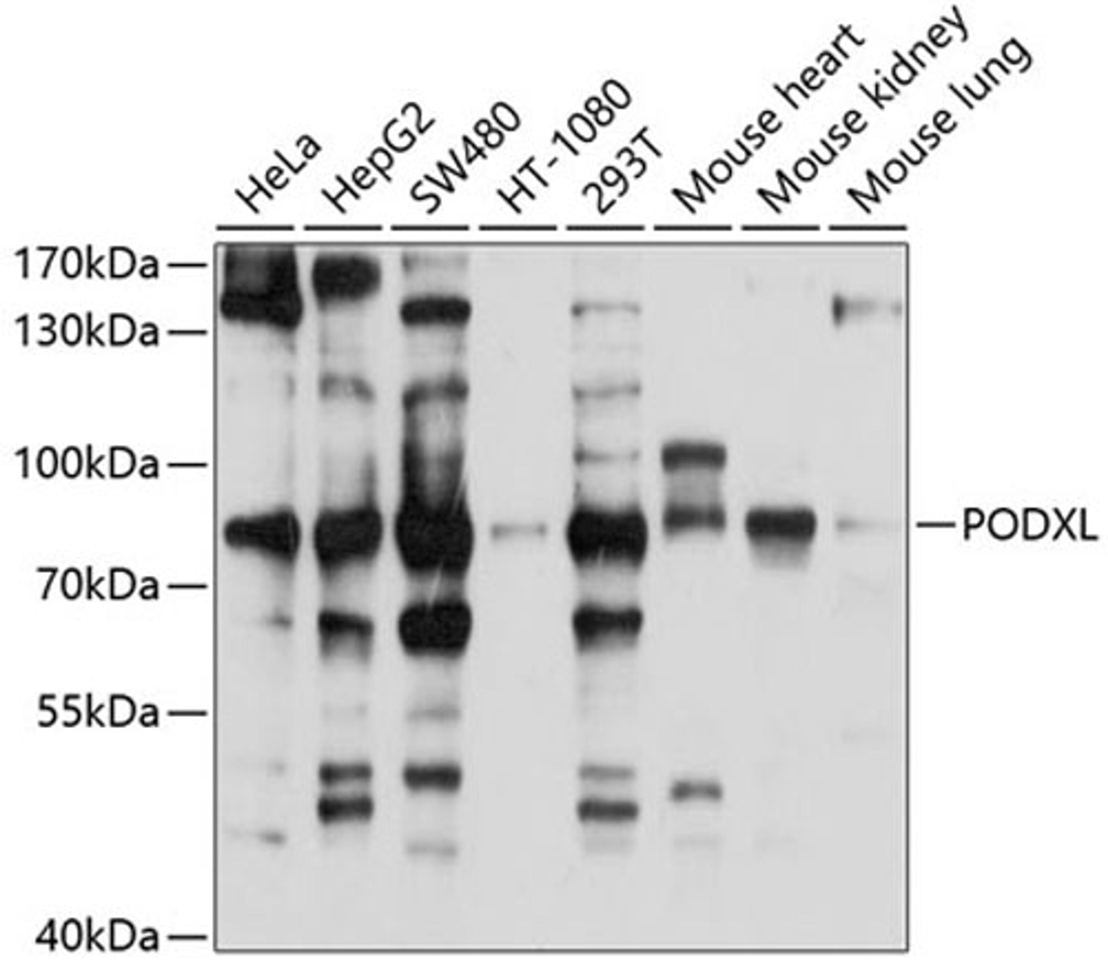 Western blot - PODXL antibody (A10200)