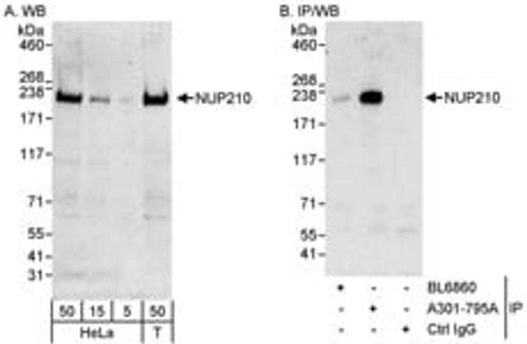 Detection of human NUP210 by western blot and immunoprecipitation.