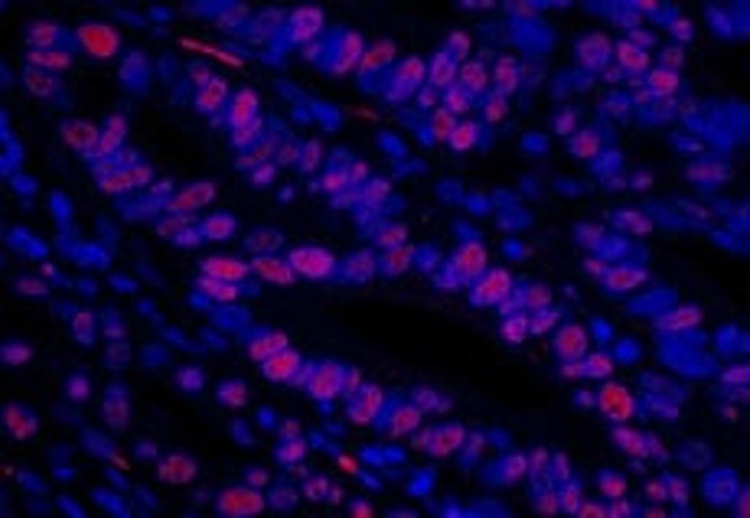 Detection of human MCM3 by immunofluorescence.