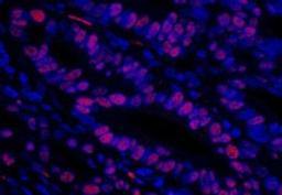 Detection of human MCM3 by immunofluorescence.