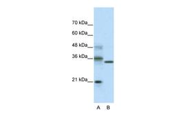 Antibody used in WB on Transfected 293T at 2.0 ug/ml.