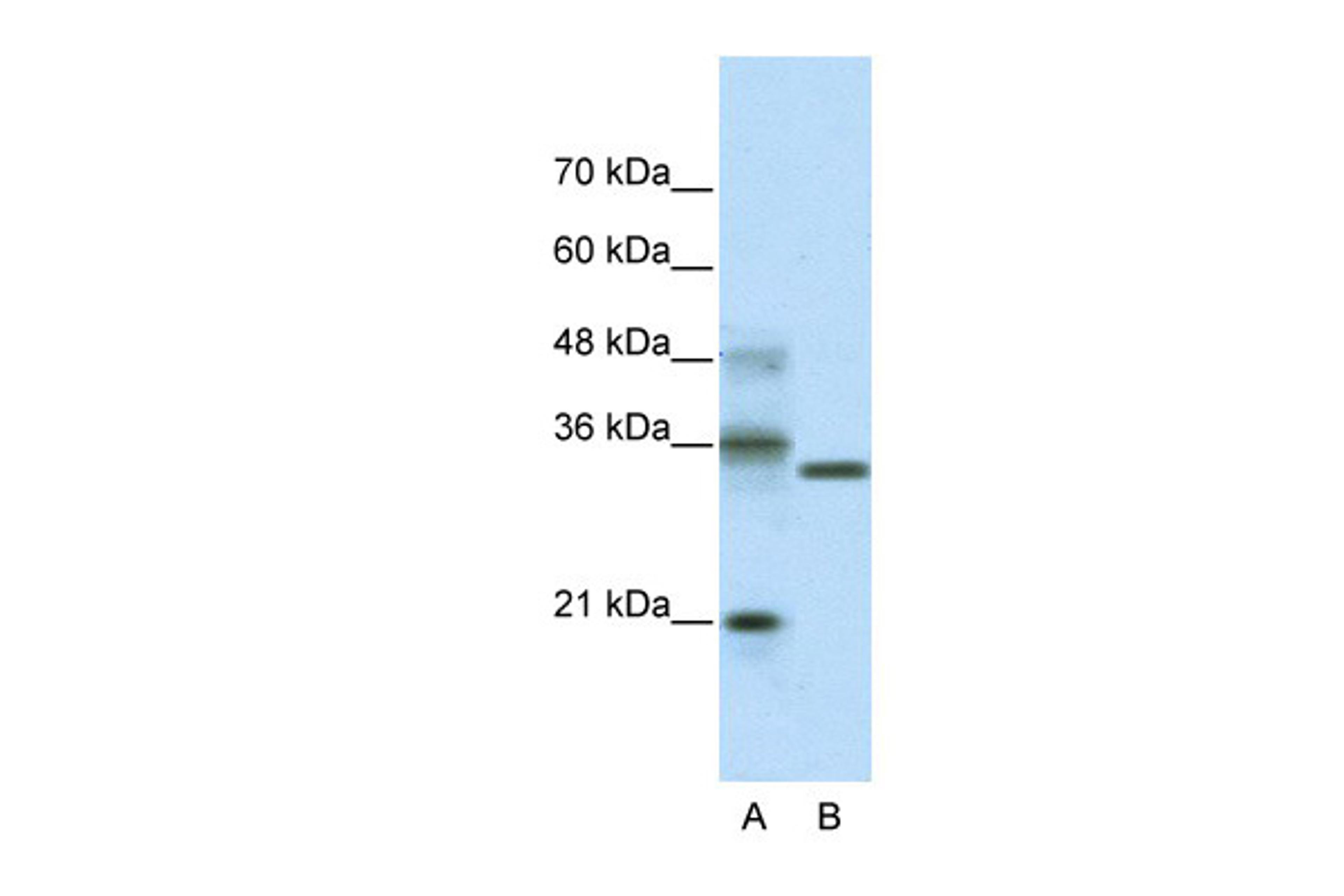 Antibody used in WB on Transfected 293T at 2.0 ug/ml.