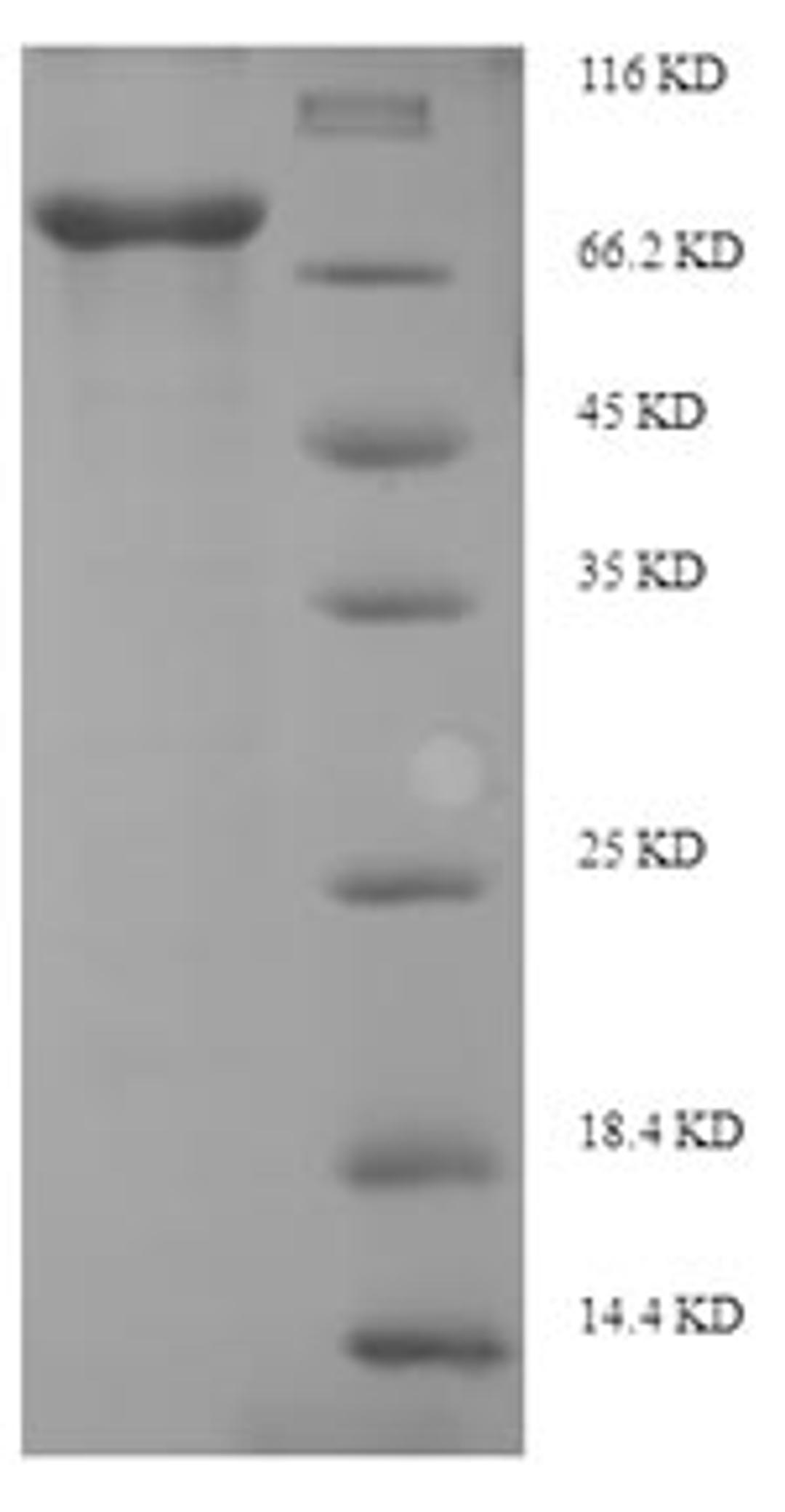 (Tris-Glycine gel) Discontinuous SDS-PAGE (reduced) with 5% enrichment gel and 15% separation gel.
