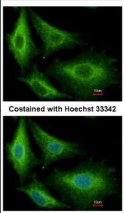 Immunocytochemistry/Immunofluorescence: Glutathione S Transferase kappa 1 Antibody [NBP2-16686] - Immunofluorescence analysis of methanol-fixed A549, using antibody at 1:500 dilution.