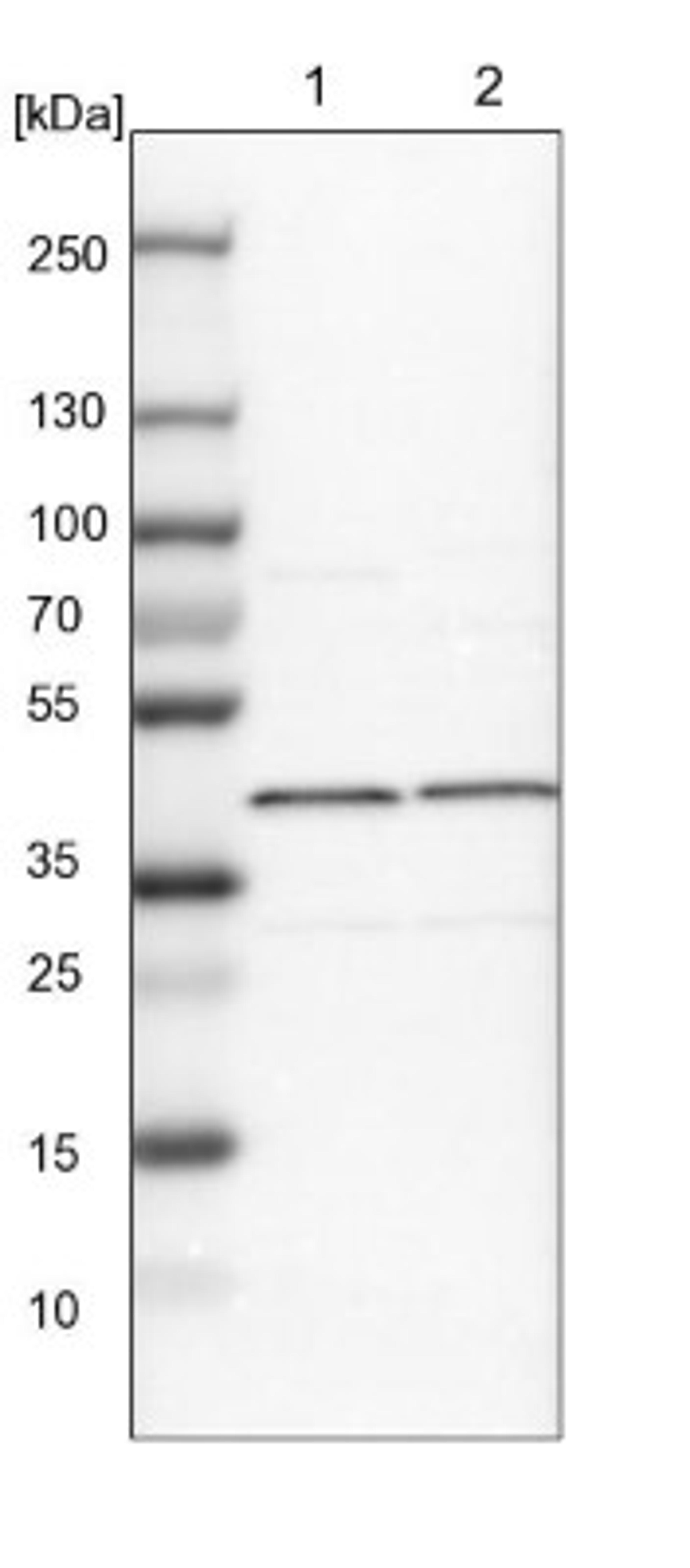 Western Blot: EIF3S3 Antibody [NBP1-84870] - Lane 1: NIH-3T3 cell lysate (Mouse embryonic fibroblast cells)<br/>Lane 2: NBT-II cell lysate (Rat Wistar bladder tumour cells)