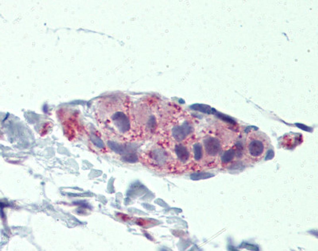 Antibody used in IHC on Human HepG2.