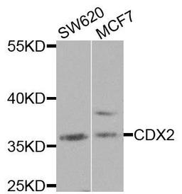 Western blot analysis of extracts of various cells using CDX2 antibody