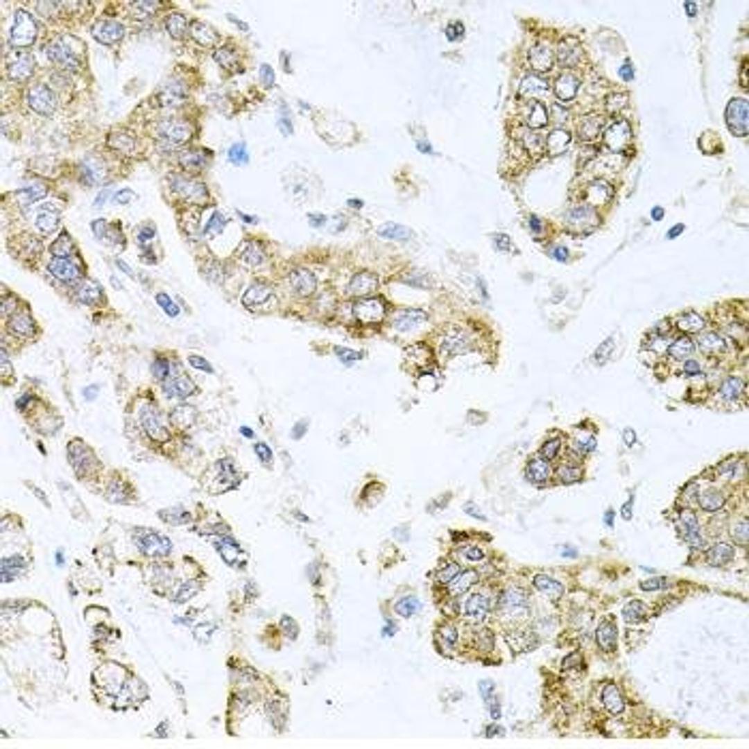 Immunohistochemical staining of mouse lung tissue using ALKBH8 antibody (dilution of 1:100)