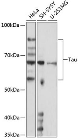 Western blot - Tau antibody (A19560)