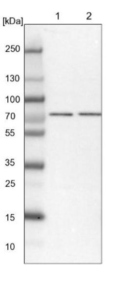 Western Blot: TARS2 Antibody [NBP1-82294] - Lane 1: NIH-3T3 cell lysate (Mouse embryonic fibroblast cells)<br/>Lane 2: NBT-II cell lysate (Rat Wistar bladder tumour cells)