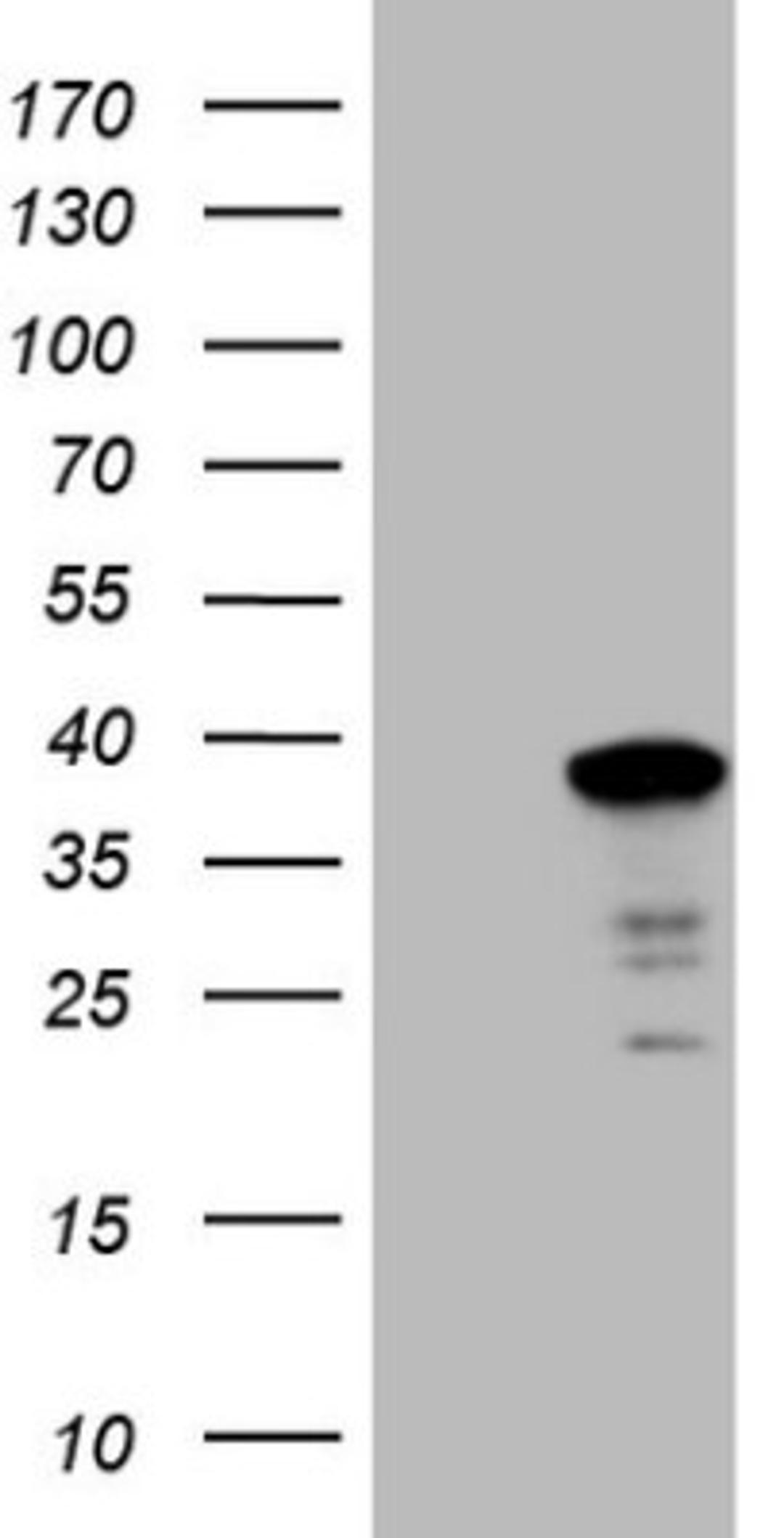 Western Blot: SYF2 Antibody (6A5) [NBP2-46033] - Analysis of HEK293T cells were transfected with the pCMV6-ENTRY control (Left lane) or pCMV6-ENTRY SYF2.