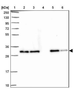 Western Blot: Clathrin light chain Antibody [NBP2-38638] - Lane 1: Marker [kDa] 250, 130, 95, 72, 55, 36, 28, 17, 10<br/>Lane 2: RT-4<br/>Lane 3: U-251 MG<br/>Lane 4: Human Plasma<br/>Lane 5: Liver<br/>Lane 6: Tonsil