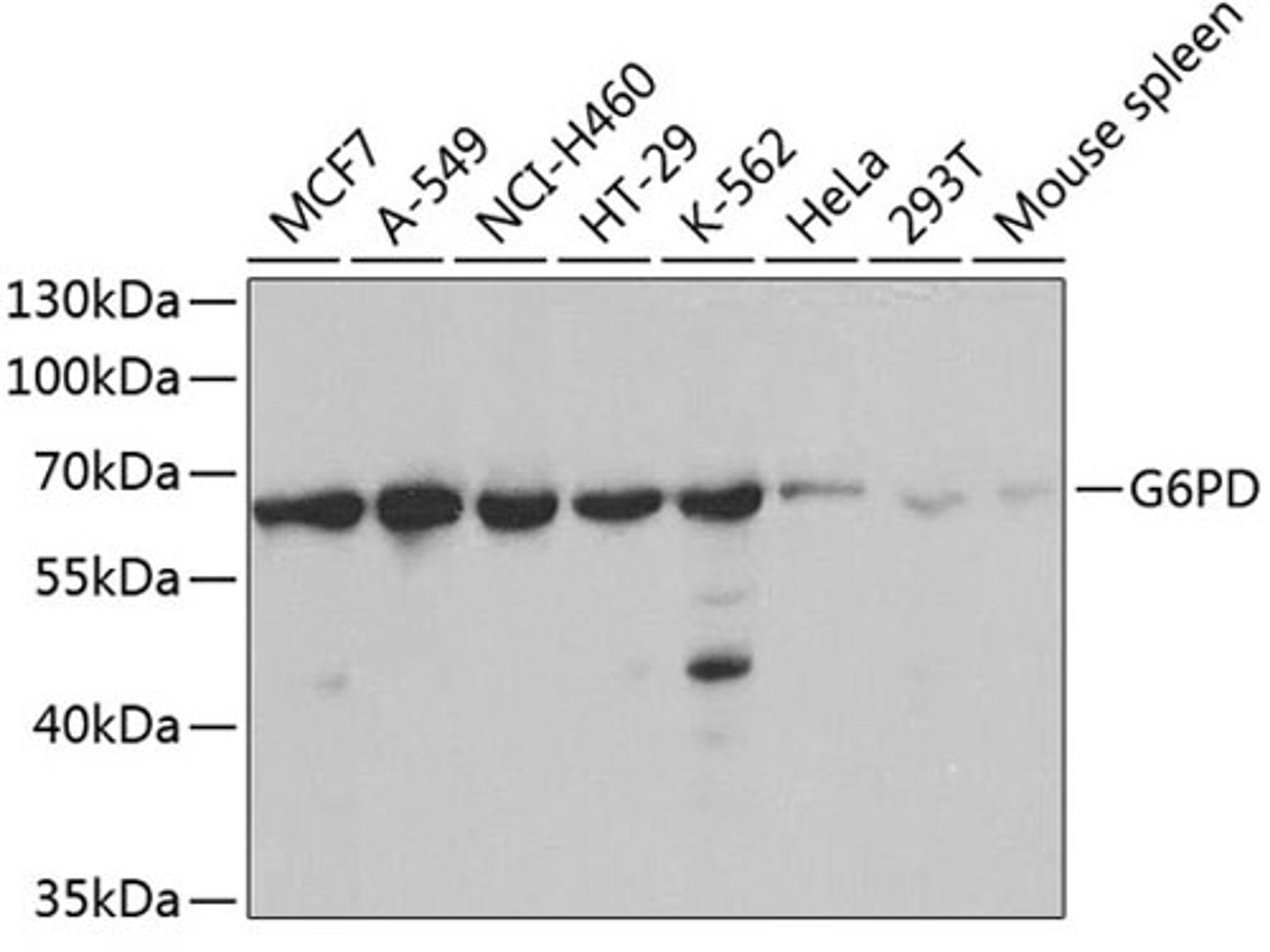 Western blot - G6PD antibody (A1537)