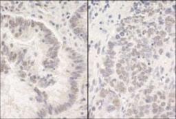 Detection of human and mouse PUF60 by immunohistochemistry.