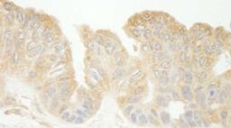 Detection of human Sec23IP(MSTP053) by immunohistochemistry.