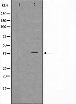 Western blot analysis of Jurkat cell lysate using NT5C3 antibody