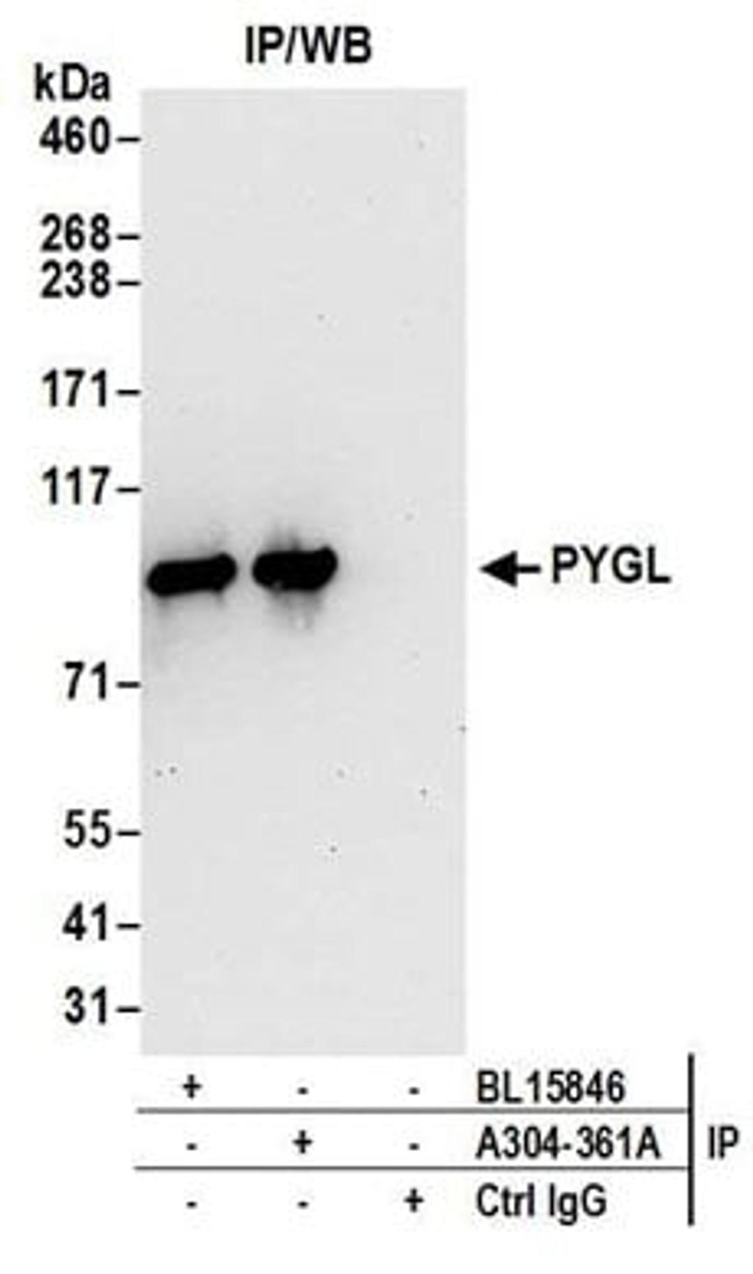 Detection of human PYGL by western blot of immunoprecipitates.