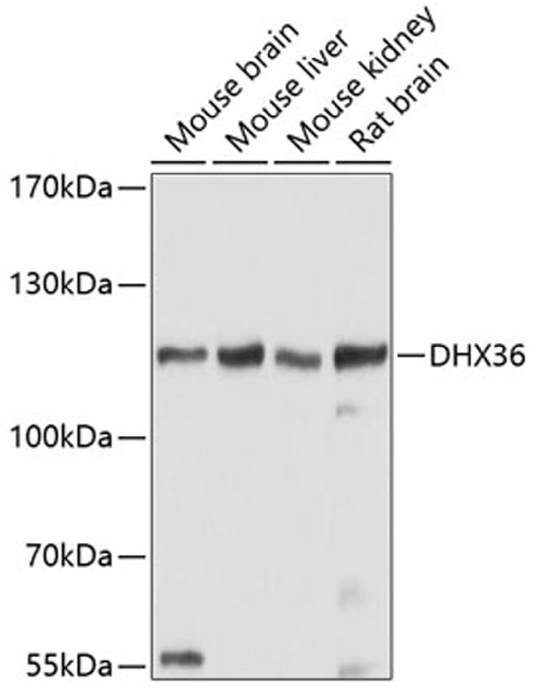 Western blot - DHX36 antibody (A5191)