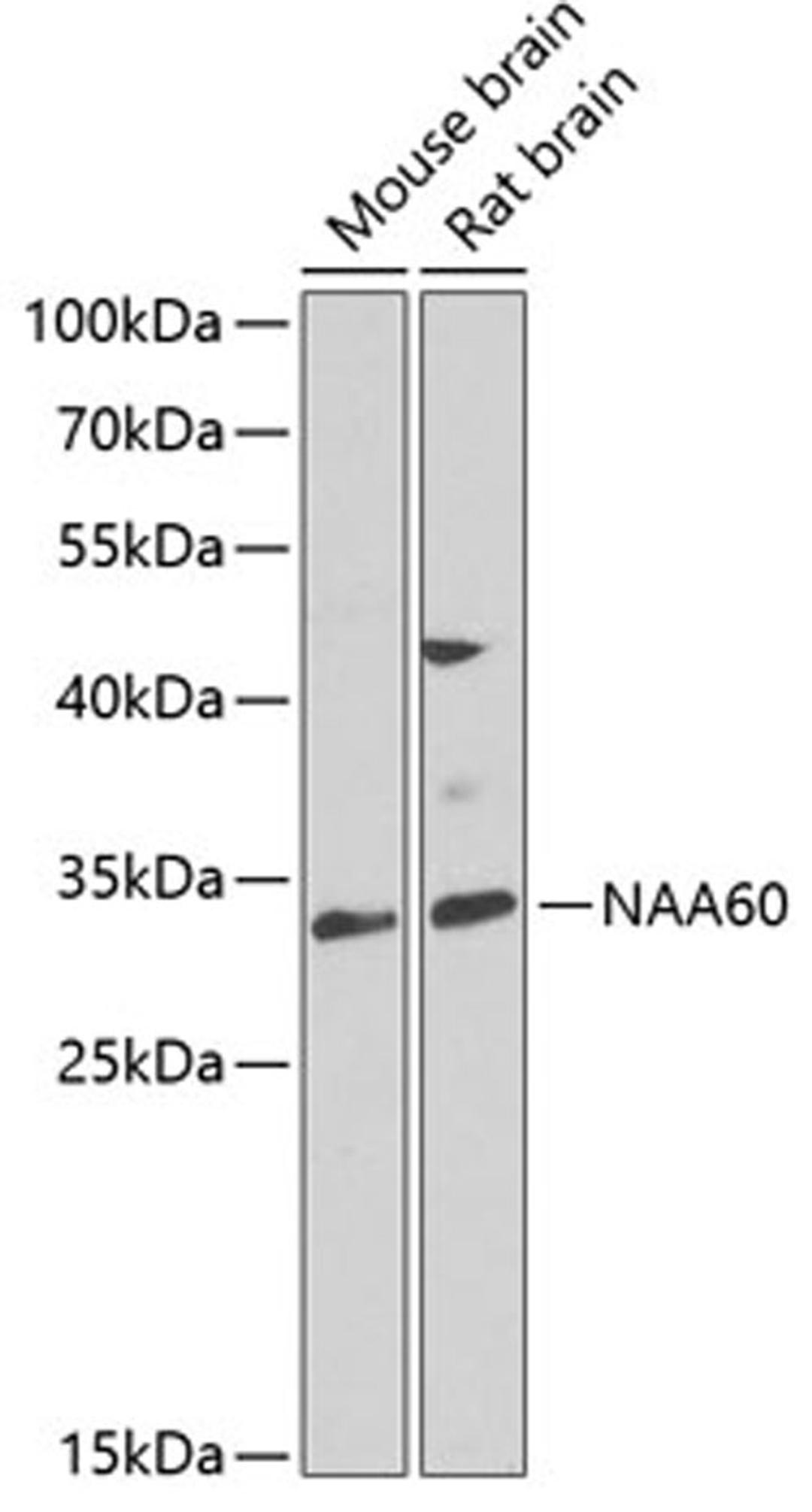 Western blot - NAA60 antibody (A7386)