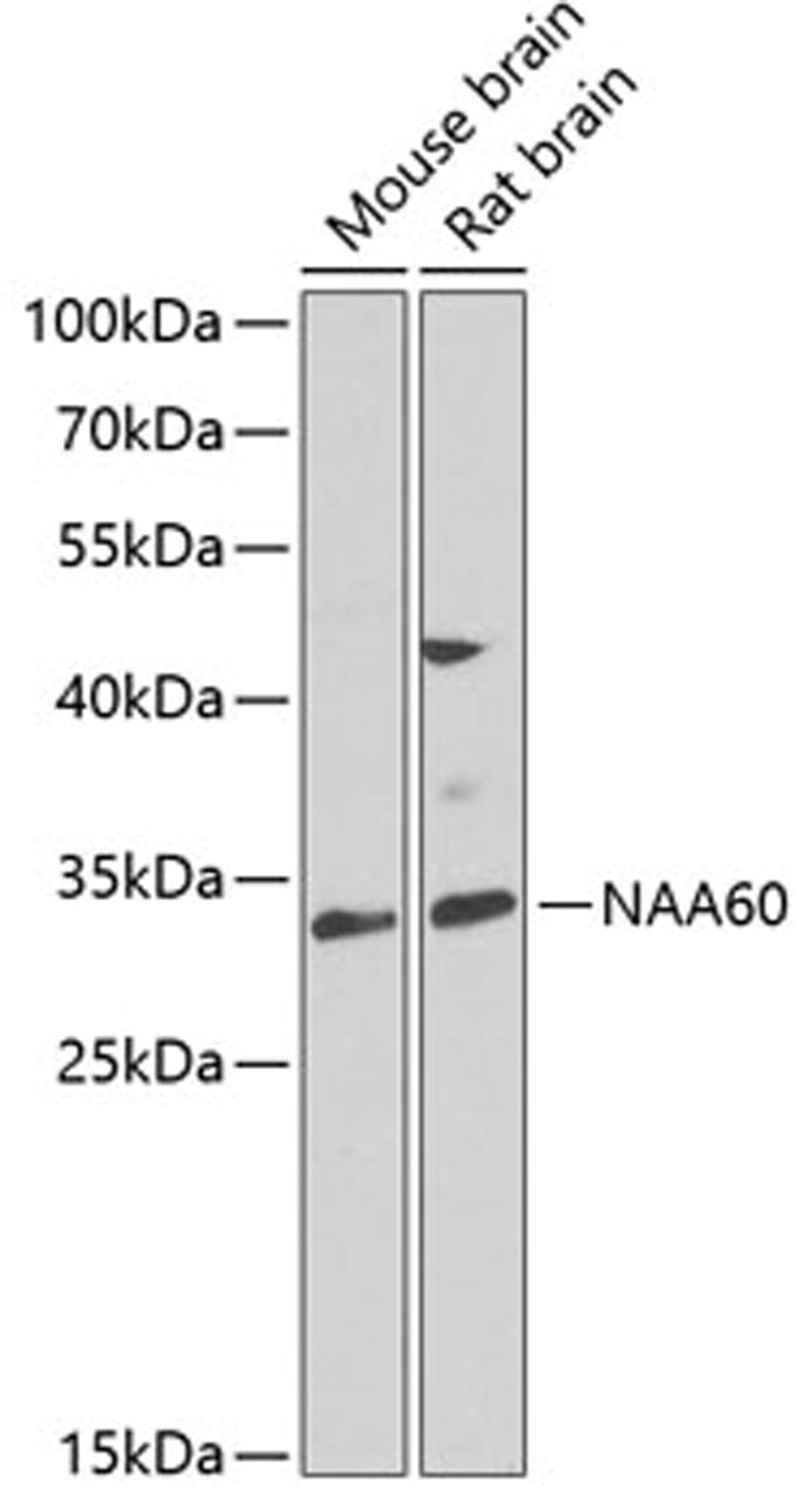 Western blot - NAA60 antibody (A7386)