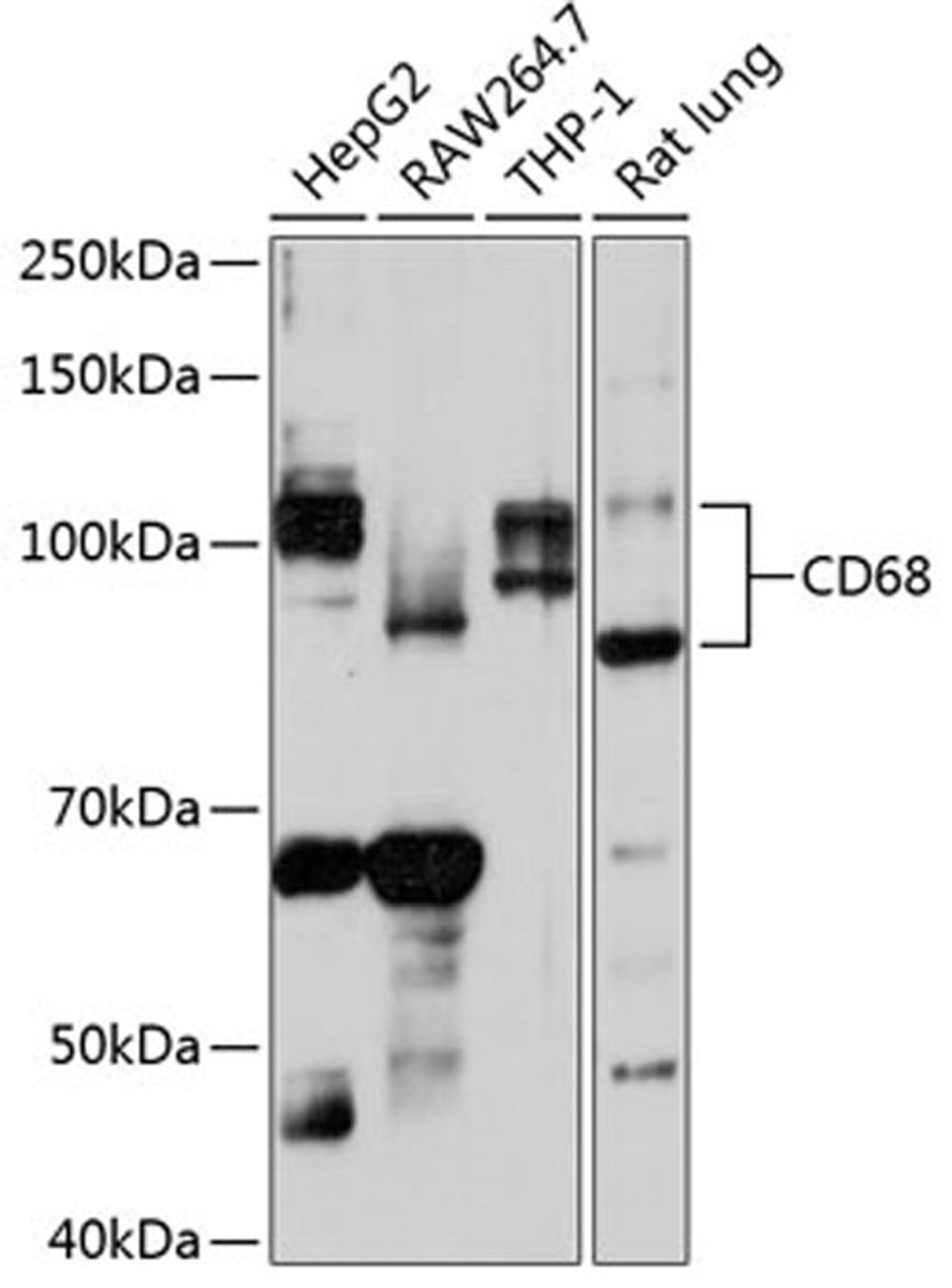 Western blot - CD68 Polyclonal Antibody (A13286)