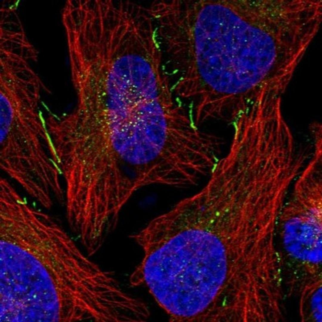 Immunocytochemistry/Immunofluorescence: DNAJC18 Antibody [NBP1-81137] - Staining of human cell line U-2 OS shows positivity in cytoplasm & cell junctions.