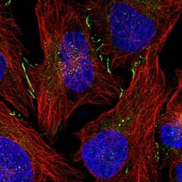 Immunocytochemistry/Immunofluorescence: DNAJC18 Antibody [NBP1-81137] - Staining of human cell line U-2 OS shows positivity in cytoplasm & cell junctions.