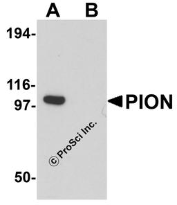 Western blot analysis of PION in EL4 cell lysate with PION antibody at 0.25 μg/mL in (A) the absence and (B) the presence of blocking peptide.