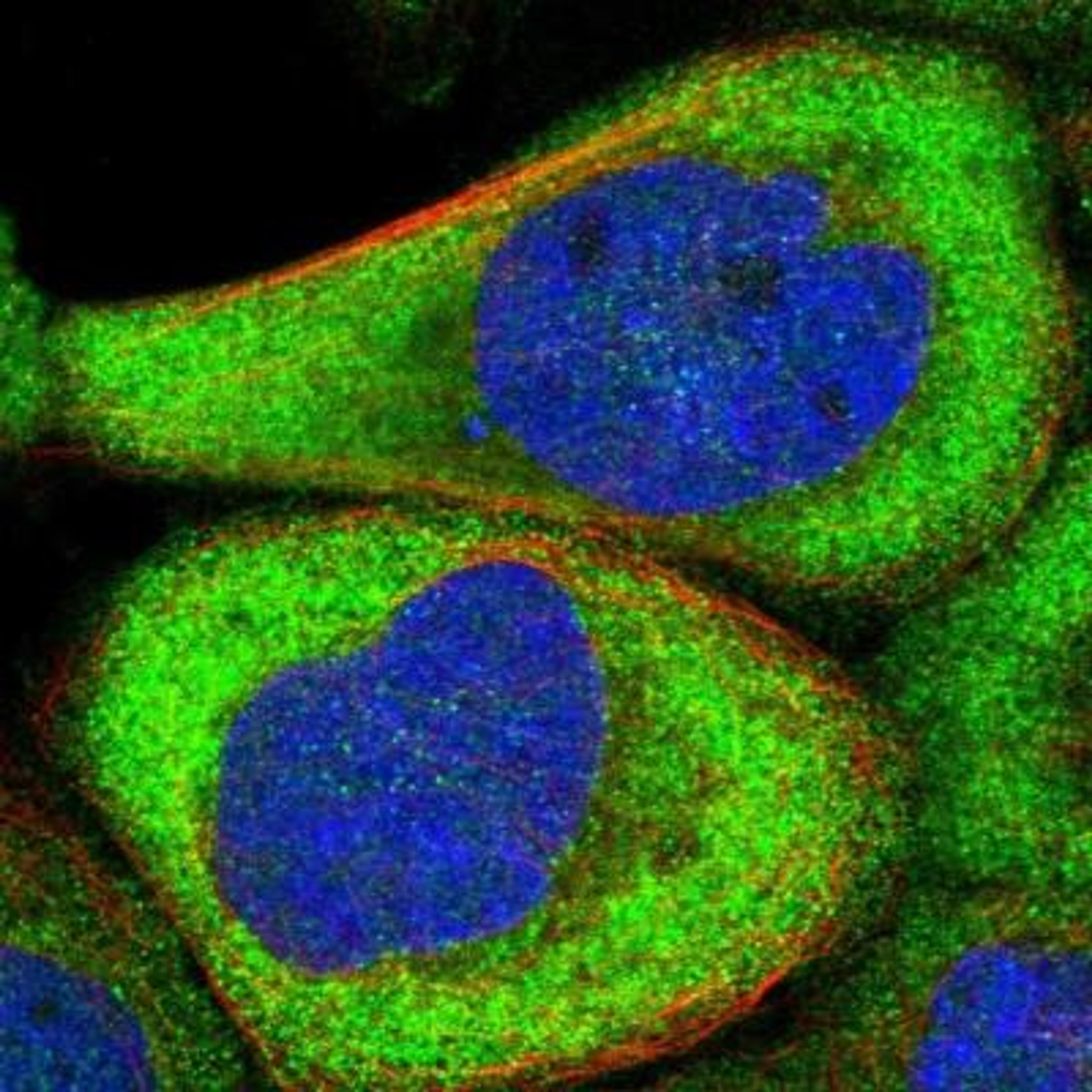 Immunocytochemistry: CPNE5 Antibody [NBP1-84406] - Immunofluorescence:  [NBP1-84406] - Staining of human cell line A-431 shows positivity in cytoplasm.