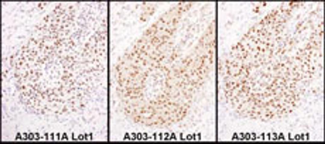 Detection of human HEXIM1 by immunohistochemistry.