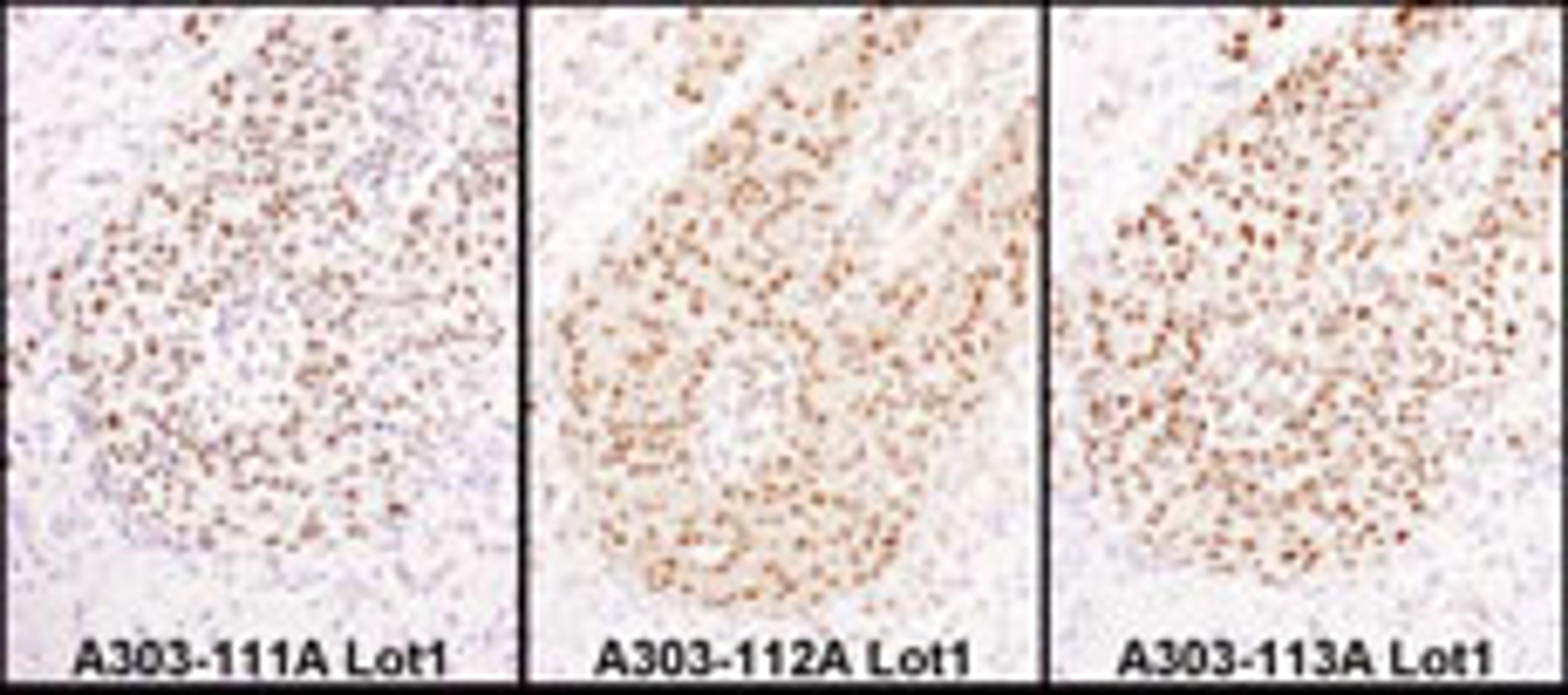 Detection of human HEXIM1 by immunohistochemistry.