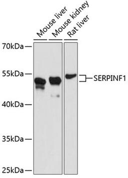 Western blot - SERPINF1 antibody (A11782)