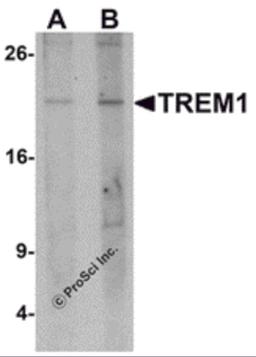 Western blot analysis of TREM1 in 293 cell lysate with TREM1 antibody at (A) 1 and (B) 2 μg/mL.