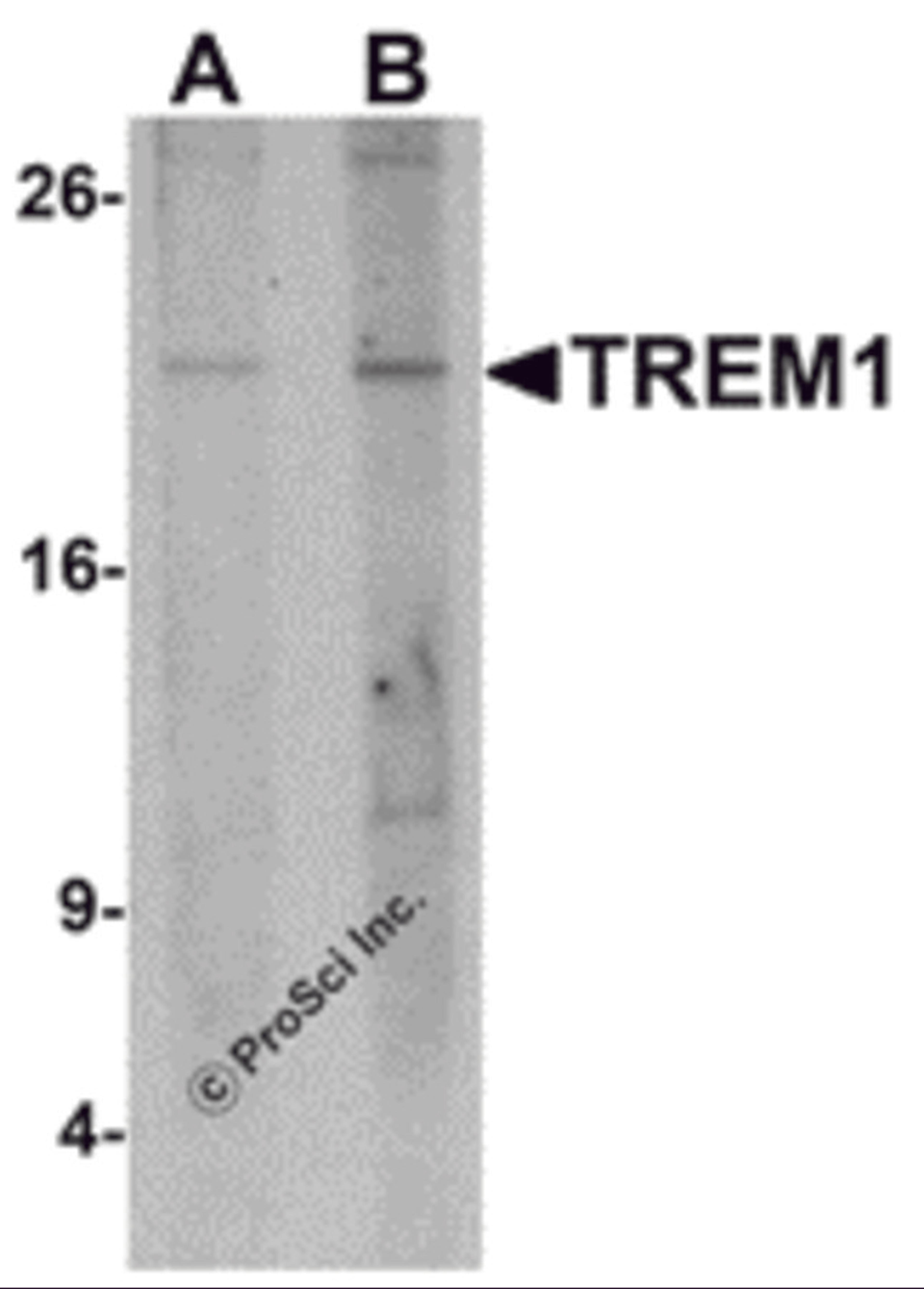 Western blot analysis of TREM1 in 293 cell lysate with TREM1 antibody at (A) 1 and (B) 2 μg/mL.