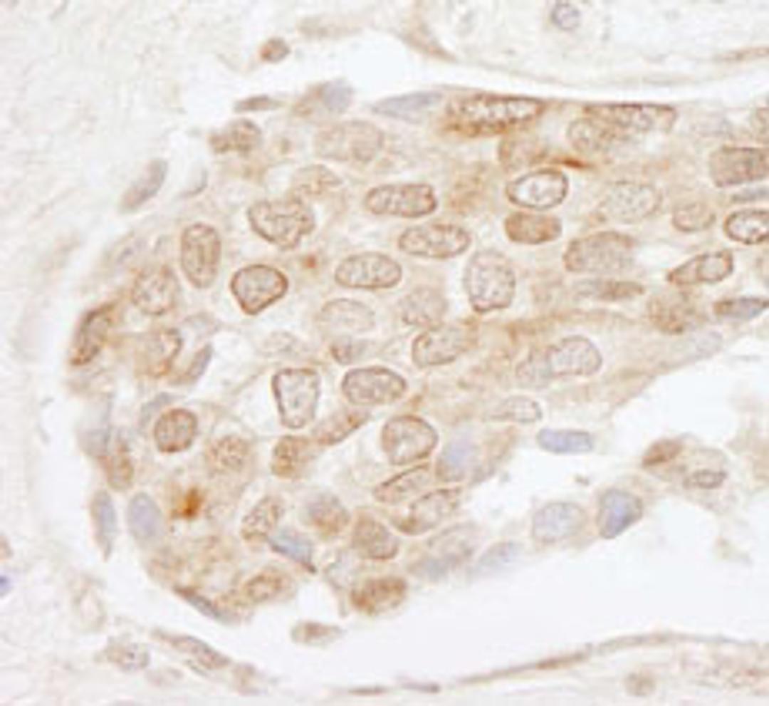 Detection of human EHMT1 by immunohistochemistry.