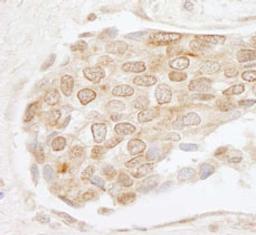 Detection of human EHMT1 by immunohistochemistry.