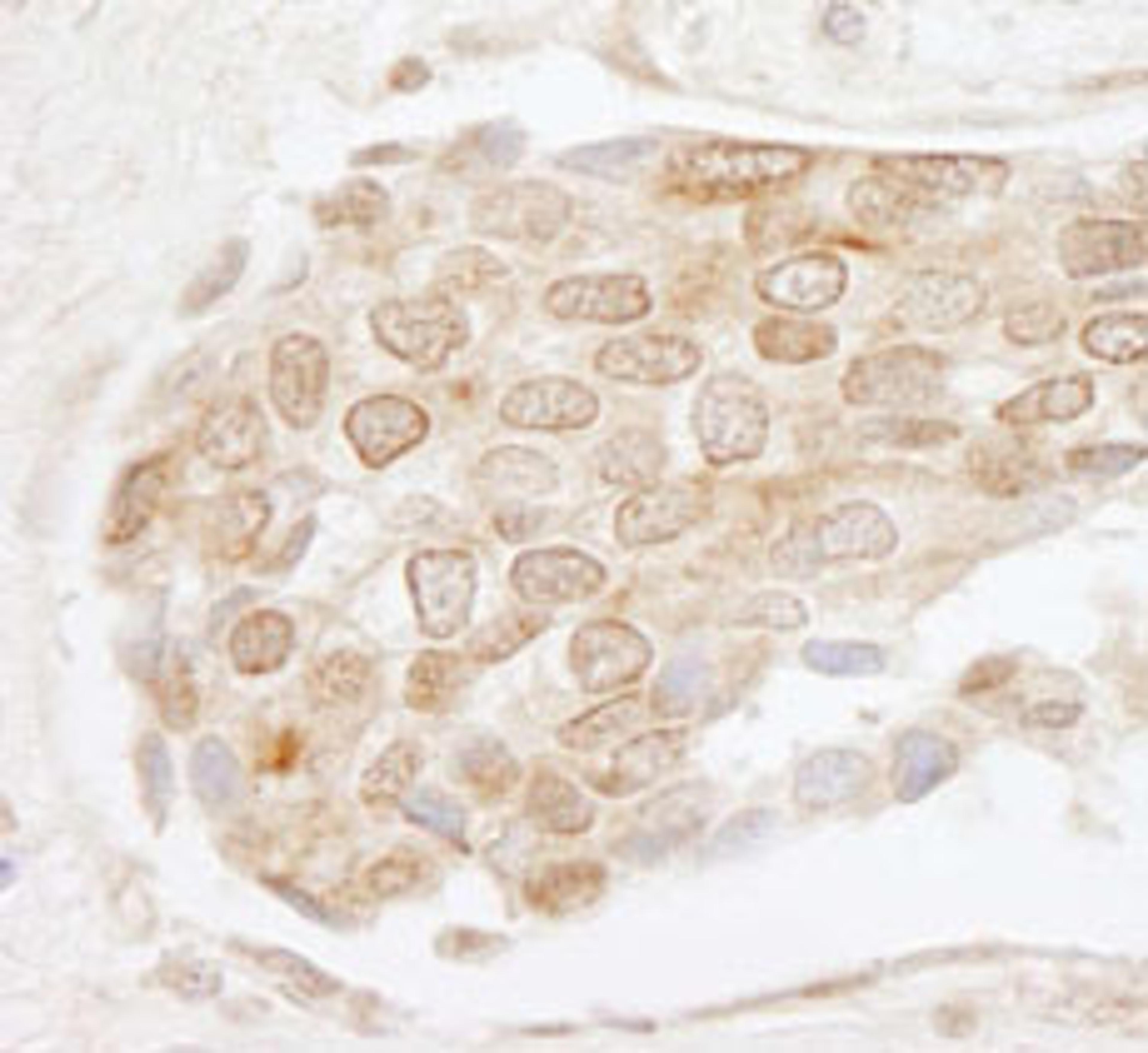 Detection of human EHMT1 by immunohistochemistry.