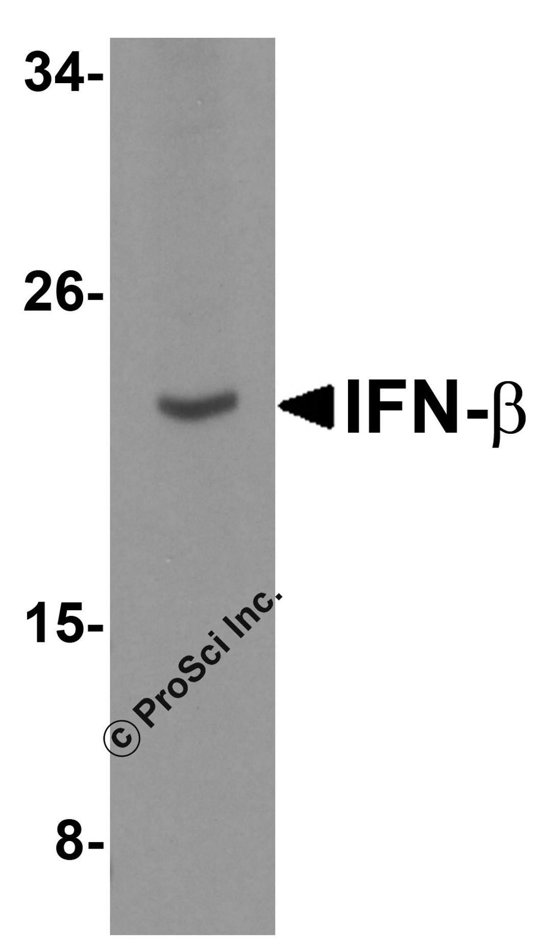 Western blot analysis of IFN-b in A-20 cell lysate with IFN-b antibody at 5 μg/mL.