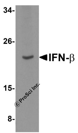 Western blot analysis of IFN-b in A-20 cell lysate with IFN-b antibody at 5 μg/mL.