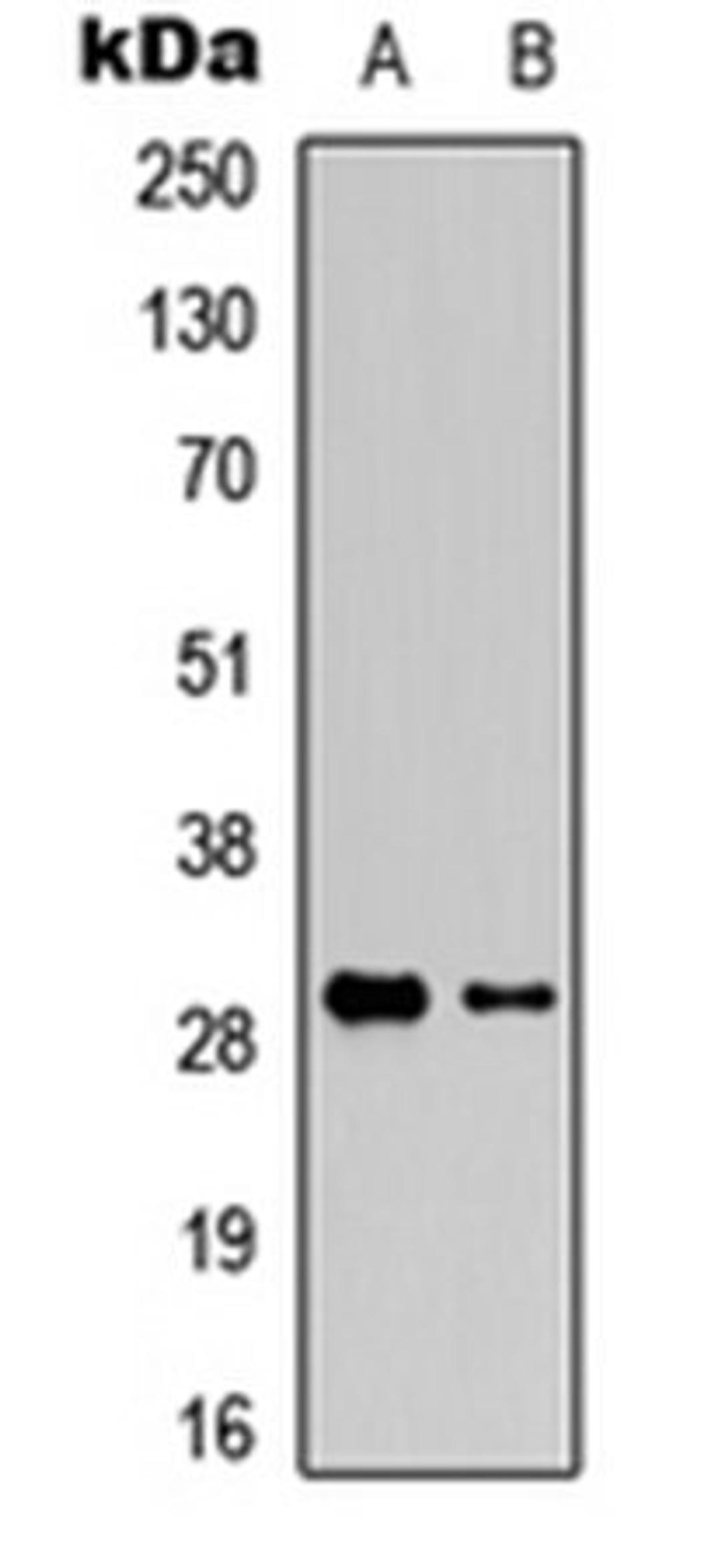 Western blot analysis of Jurkat (Lane 1), mouse liver (Lane 2) whole cell lysates using Granzyme K antibody