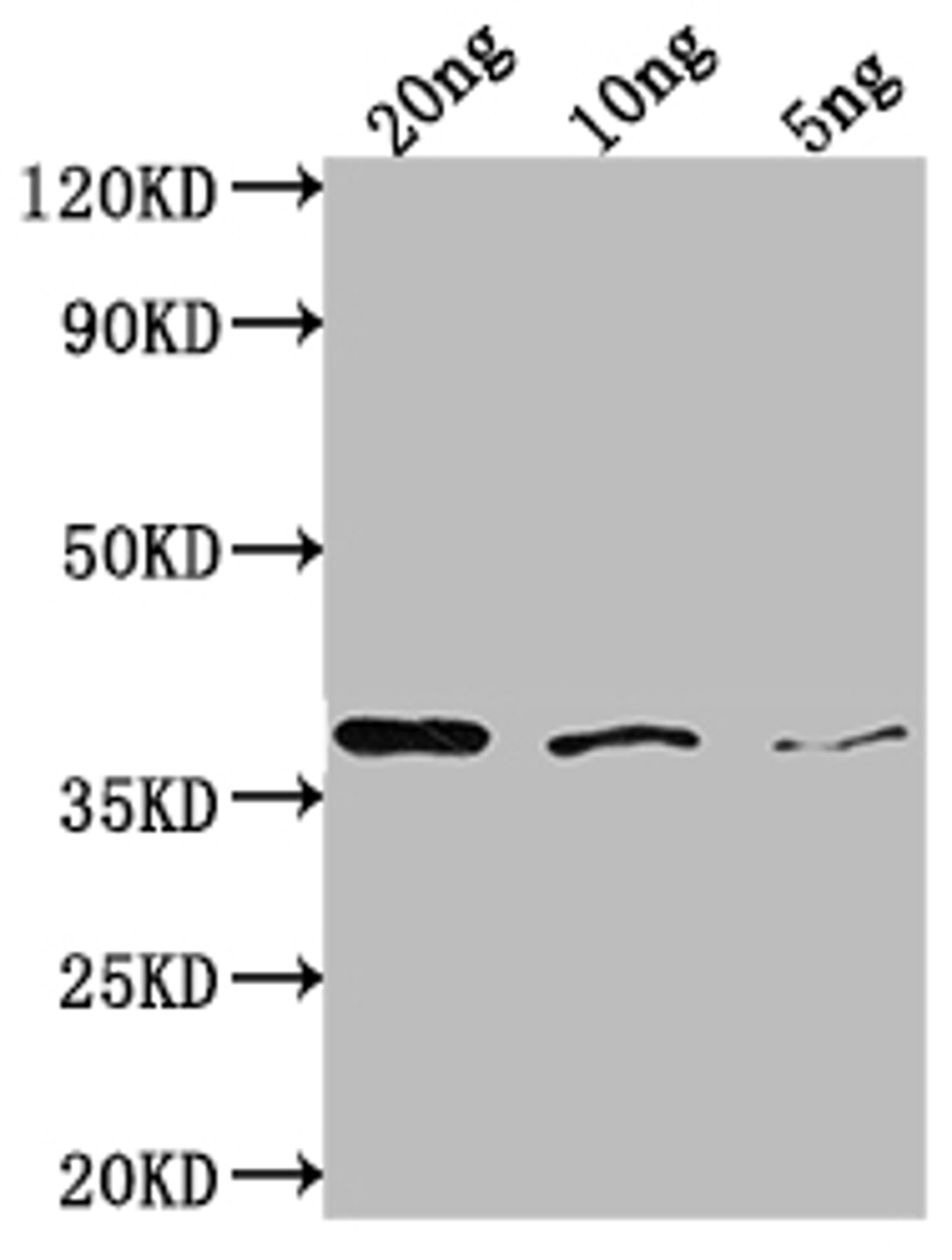 Western Blot. Positive WB detected in Recombinant protein. All lanes: bamA antibody at 1:2000. Secondary. Goat polyclonal to rabbit IgG at 1/50000 dilution. Predicted band size: 36 kDa. Observed band size: 38 kDa.