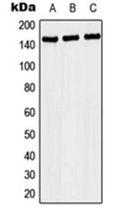 Western blot analysis of MCF7 (Lane 1), SP2/0 (Lane 2), H9C2 (Lane 3) whole cell lysates using NACAD antibody